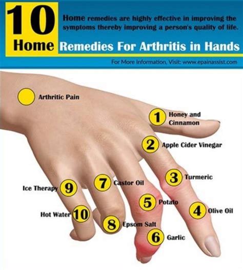 Die besten 25+ Gout in hands Ideen auf Pinterest | Arthritis in den ...