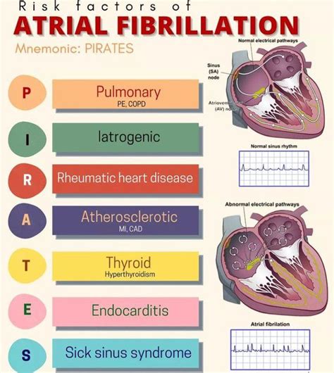 Risk factors of atrial fibrillation - MEDizzy