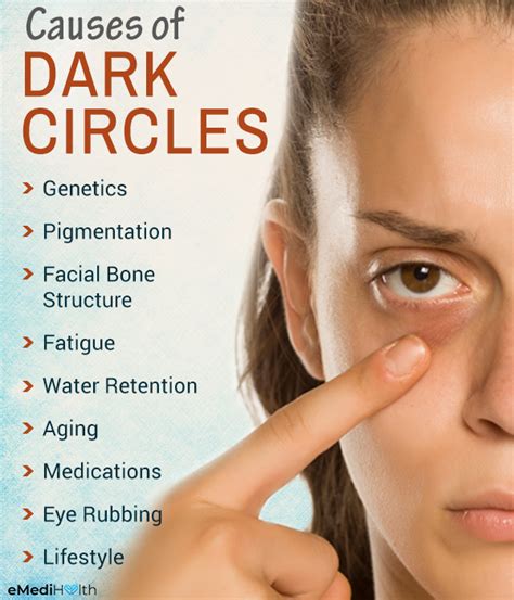 Possible Causes of Dark Circles and Treatment Options