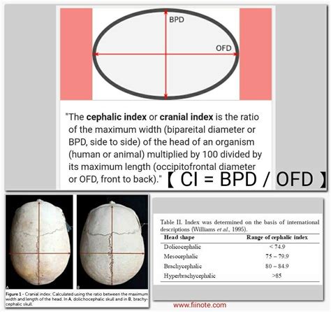 Cephalic Index - Biparietal diameter / Occipitofrontal diameter ... (*) Doli Me Bride Hai ...