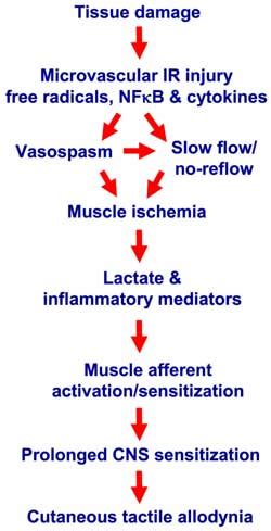 When Touch Hurts and Blood Matters: Getting at the Pain in Fibromyalgia ...