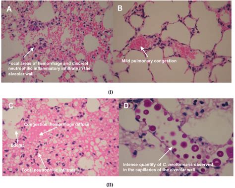 Histological analysis of lung tissue, of immunocompetent mice (image... | Download Scientific ...