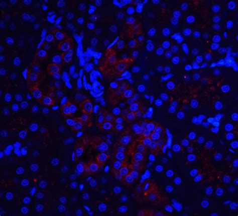 IL-22 Receptor Antibody - Cat. No. 2497 | ProSci