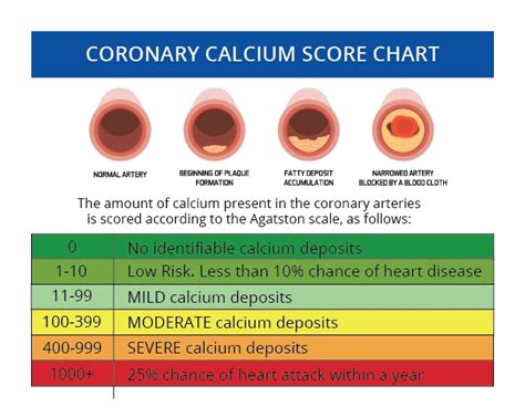 Calcium Score