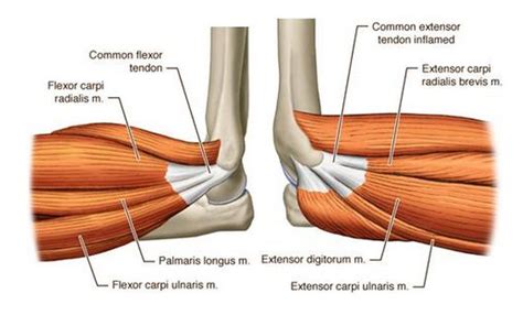 Common flexor tendon Flexor carpi radialis Palmaris longus Flexor carpi ulnaris | Arms Hands ...