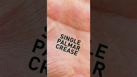 Single Palmar Crease Meaning #shorts - YouTube