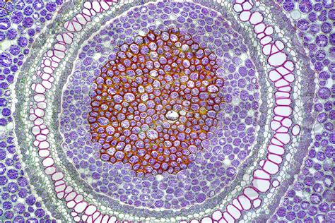 Dennstaedtia sp. Rhizome. Amphiphloic siphonostele. Transverse section. 125X - Dennstaedtia sp ...