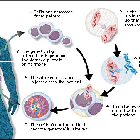 Viral vector mediated gene therapy. | Download Scientific Diagram