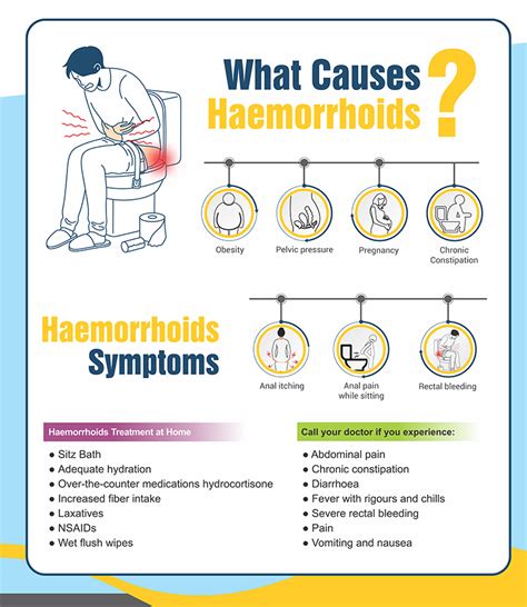 Hemorrhoids/Piles: Diagnosis, Treatment & Prevention