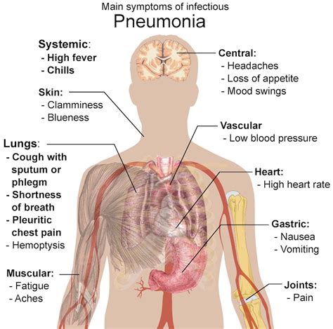 Pneumonia Virus Symptoms