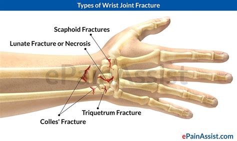 Pin on ortho