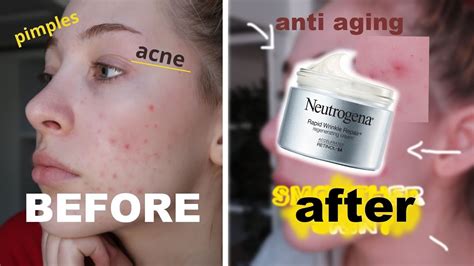 Neutrogena Rapid Wrinkle Repair Review !! *not sponsored* // retinol for acne. - YouTube