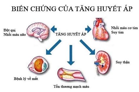 Tăng huyết áp - Kẻ giết người thầm lặng | Trạm Y tế Phường 13