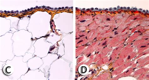 e-heart.org Cardiovascular Pathology Home Page