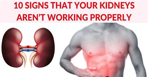 Do Kidney Stones Hurt Constantly - HealthyKidneyClub.com