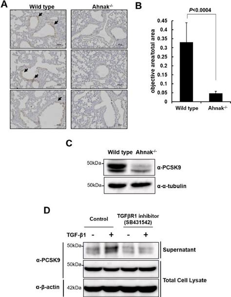 PCSK9 Monoclonal Antibody (2F1) (MA5-32843)