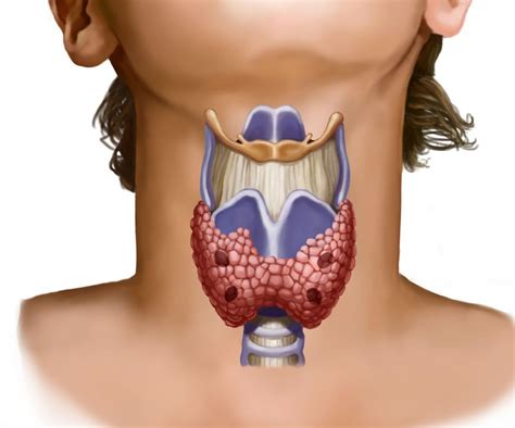 Thyroid nodules diagnosis. Thyroid nodules treatment. Must know
