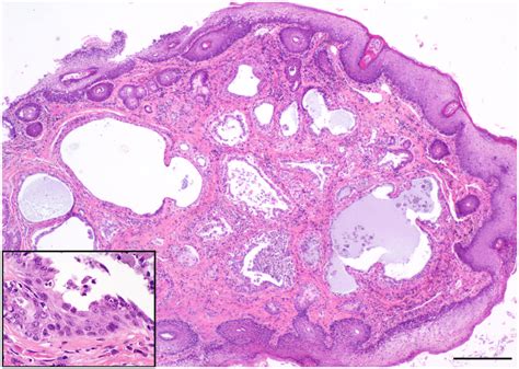 Photo of hematoxylin and eosin—stained histopathology slide of... | Download Scientific Diagram