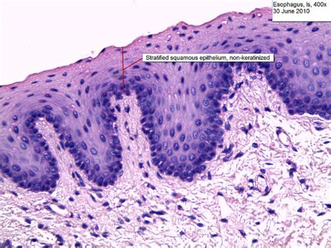 Difference Between Keratinized and Nonkeratinized Epithelium | Compare ...