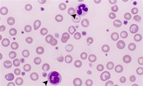 Normal Platelets – Cells and Smears