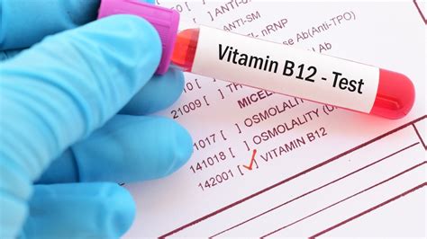 Vitamin B12 and Menopause