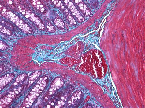 JMDHistology.com Histology slides | Histology slides, Medical illustration, Microscopic cells