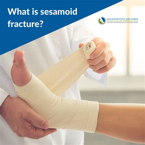 Another injury concerning the sesamoids is a sesamoid fracture. Fractures may be acute or ...