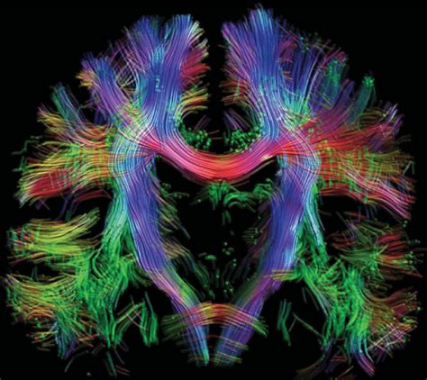 2: Fiber Tractography in the human brain. [Second image adapted from [1].] | Download Scientific ...