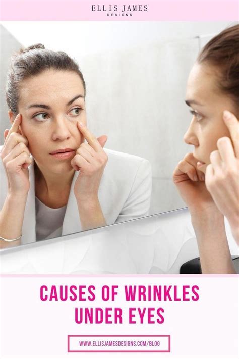 Under Eye Lines, Under Eye Creases, Dry Under Eyes, Remove Eye Wrinkles, What Causes Wrinkles ...
