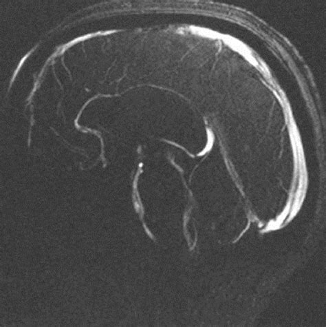 Phase-Contrast MRI: Physics, Techniques, and Clinical Applications | RadioGraphics