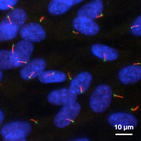 Imaging Cilia and Centrioles Below the Diffraction Limit - Scientific Technology News