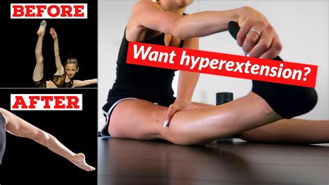 Hyperextended Knee Exercises - How To Fix Banana Knees Knee ...