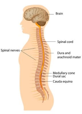 What Is a Dural Leak? - Regenexx