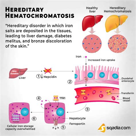 Part I Hemochromatosis | Strive For Good Health