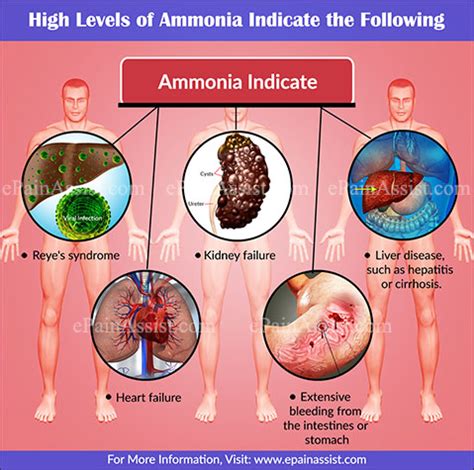 What Does Ammonia Level Indicate?