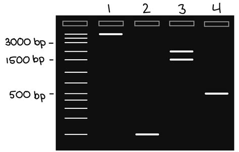 Gel electrophoresis well explained - Laboratory Insider