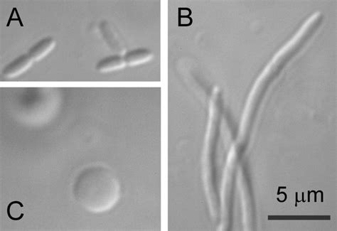 Steps in the giant spheroplast preparation as viewed by DIC microscopy.... | Download Scientific ...