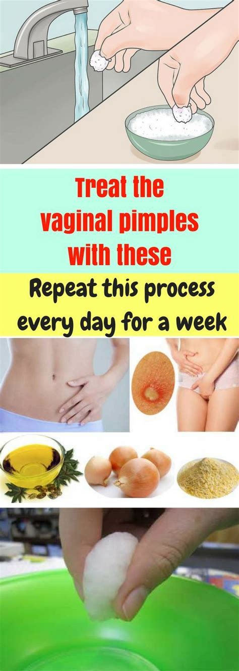 Let Start Slim Today: Treat The Vaginal Pimples with These Natural Remedies!!!