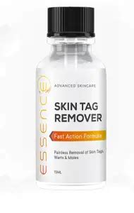 I Bought Defy Skin Tag Remover: Here is my Honest Reviews