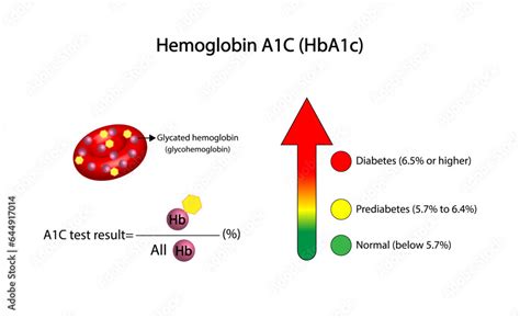 Hemoglobin A1C, HbA1c test , HbA1c levels, Glucose sticks to hemoglobin, glycated hemoglobin, up ...