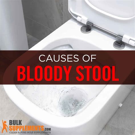 Rectal Bleeding (Bloody Stool): Causes, Symptoms & Treatment