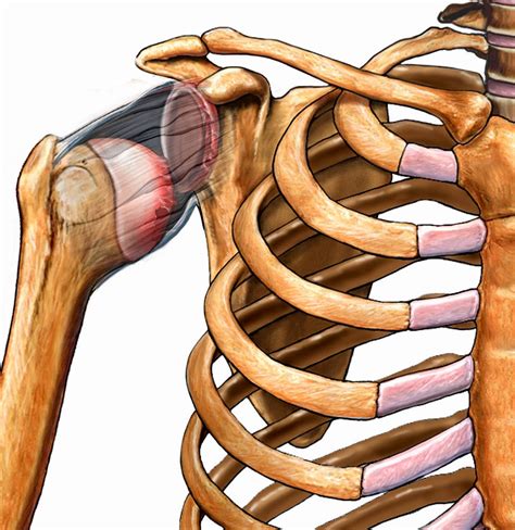 Shoulder and Elbow Surgery: Dislocated Shoulder - Patient education