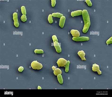 Vibrio alginolyticus bacteria, SEM Stock Photo - Alamy