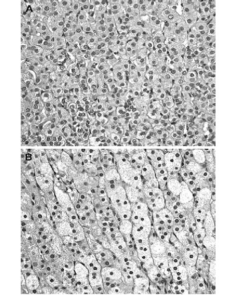 Histological appearance of cortical cells in the zona fasciculata and... | Download Scientific ...