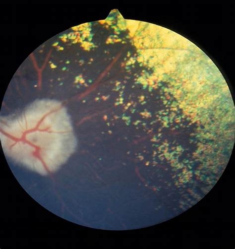 Image: Progressive retinal atrophy, dog - MSD Veterinary Manual