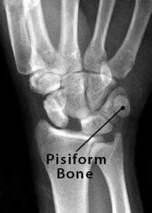 Pisiform Bone Definition, Location, Anatomy, Functions, & Diagram