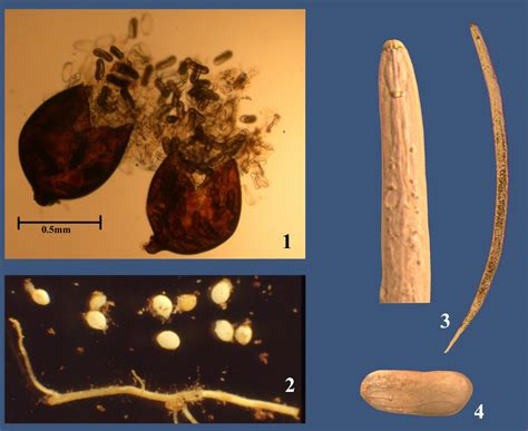 Turf: Comprehensive Nematode Evaluation | UMass Center for Agriculture, Food and the Environment