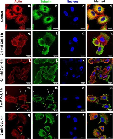 Laser Confocal Fluorescence Microscopy Lcfm Images Of A