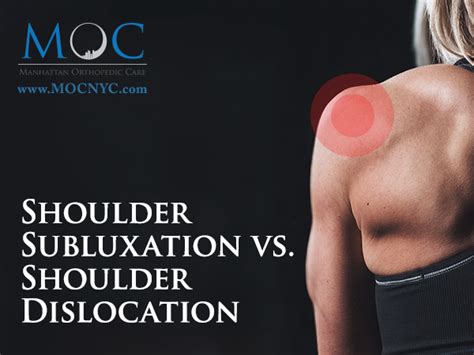 Shoulder Subluxation vs. Shoulder Dislocation