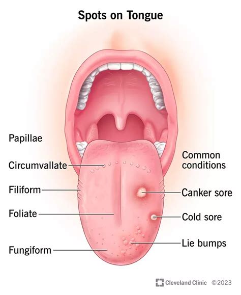 There are many reasons why you might have spots on your tongue. First, healthy tongues have lots ...